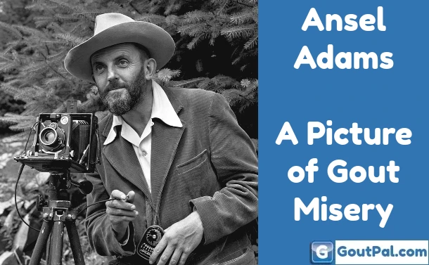 Ansel Adams – A Picture of Gout Misery