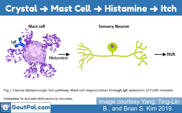 UA Crystal ➜ Mast Cell ➜ Histamine ➜ Itch