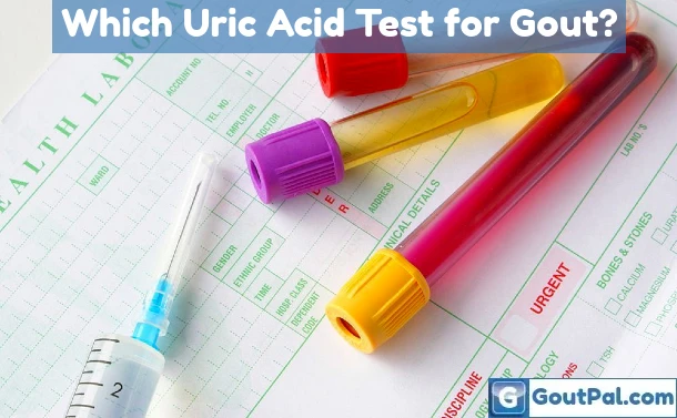 Which Uric Acid Test for Gout?