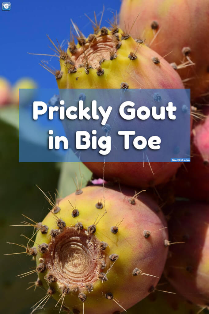 Prickly Gout in Big Toe photo