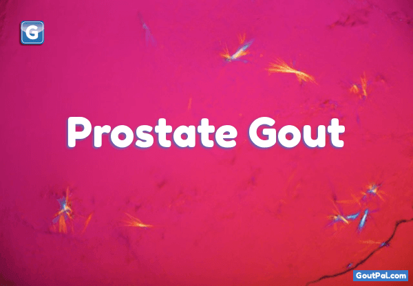 Prostate Gout image